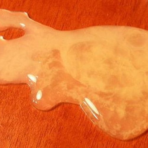 Comment améliorer la qualité du sperme